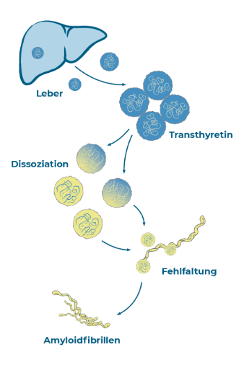 Wie entsteht Amyloidose?